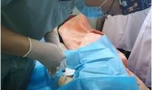 银质针视频,揭秘古老针法的现代应用与疗效